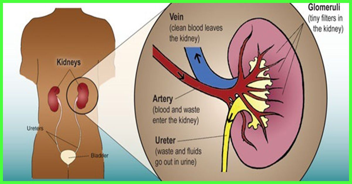 how-to-sleep-with-kidney-stones-healthykidneyclub