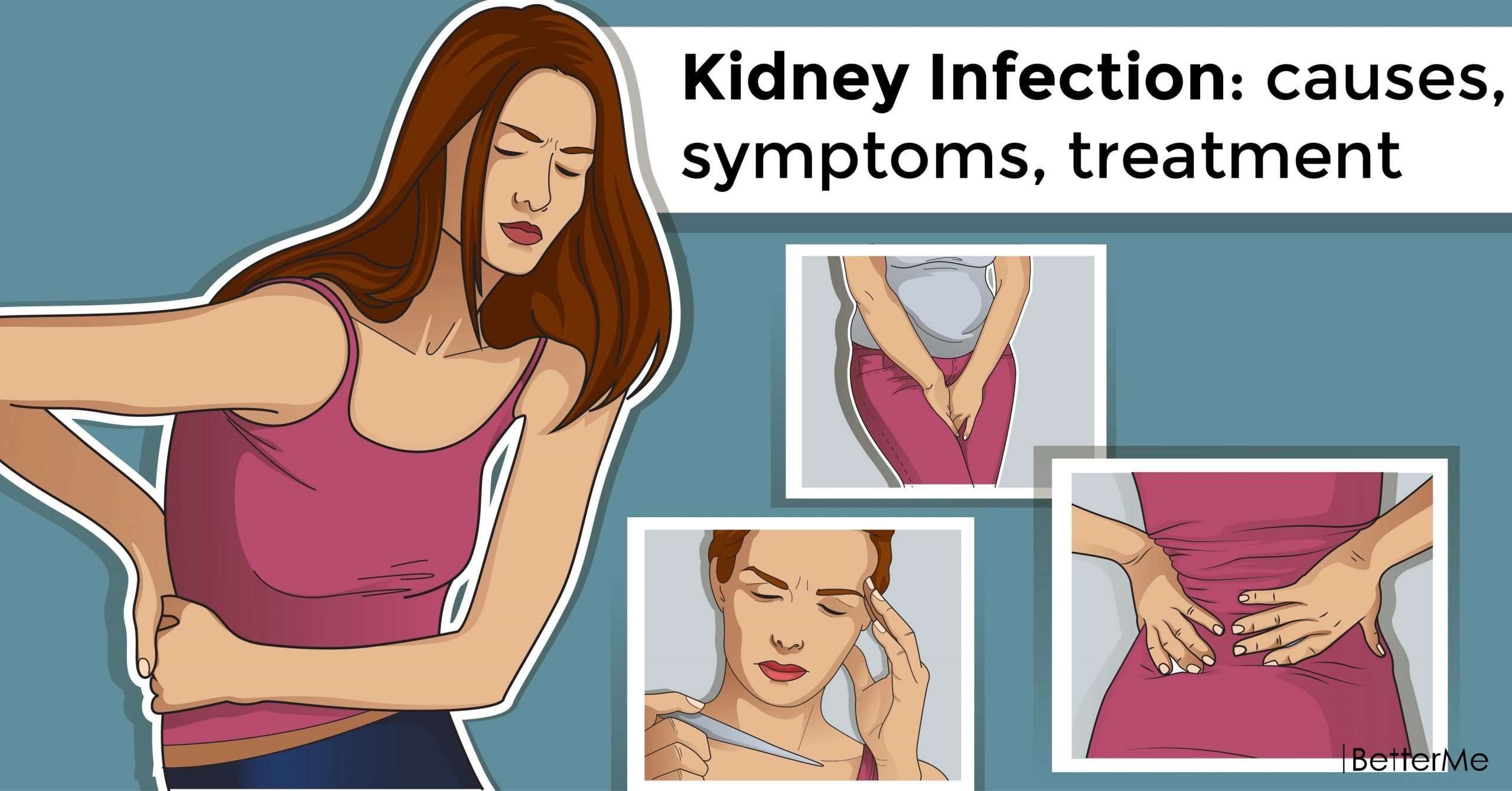 Kidney Infection: causes, symptoms, treatment
