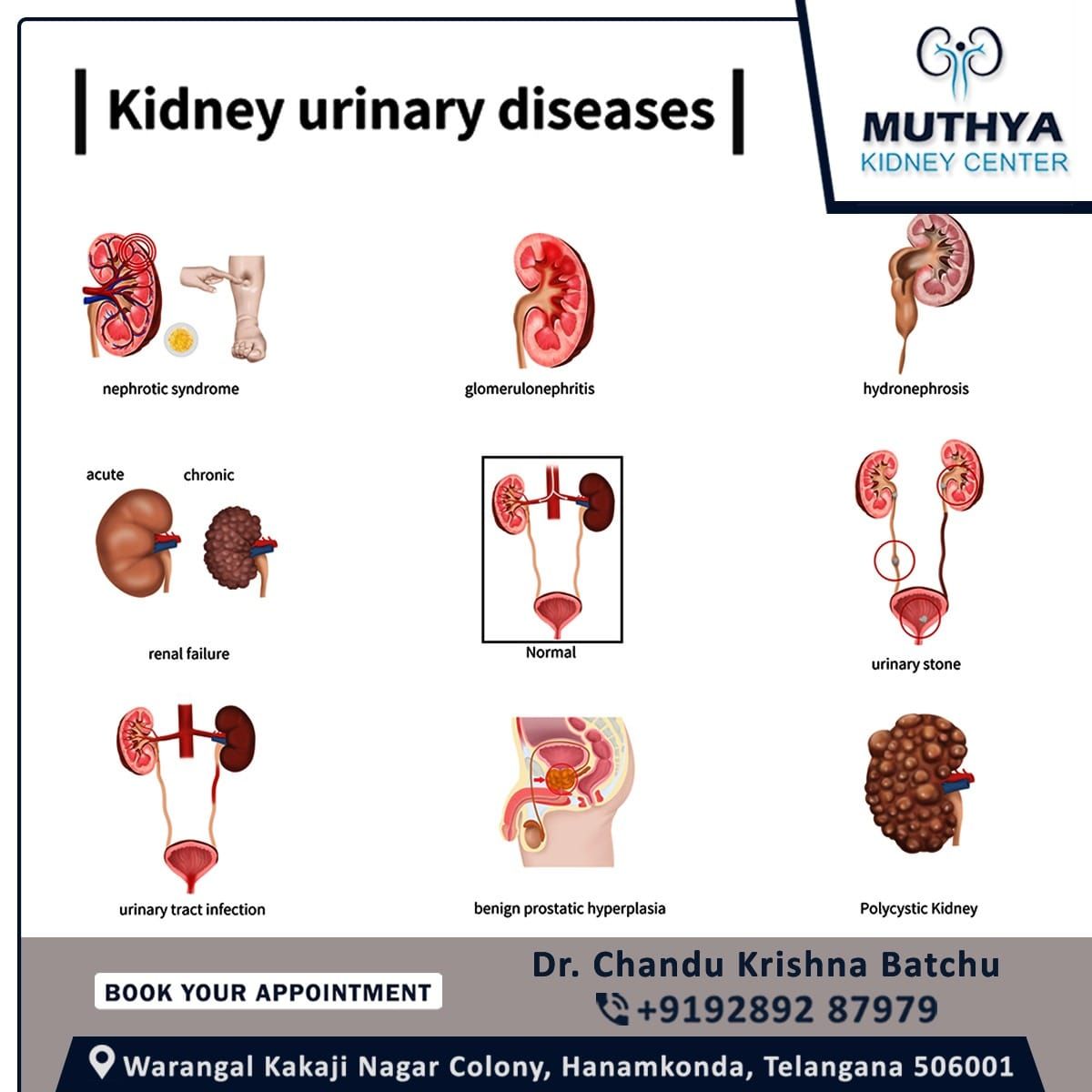 Kidney infection (pyelonephritis) is a type of urinary tract infection ...