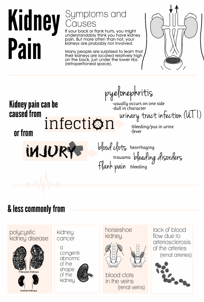 What Can Cause Kidney Pain On One Side