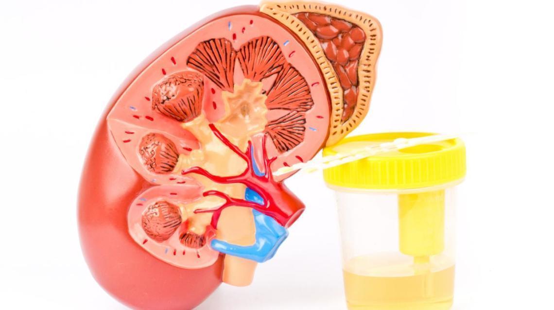 Kidney Stone Affect Ejaculation