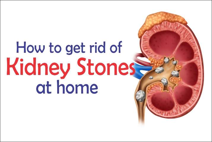 kidney stone diet,kidney stone treatment,kidney stone pain,pain relief