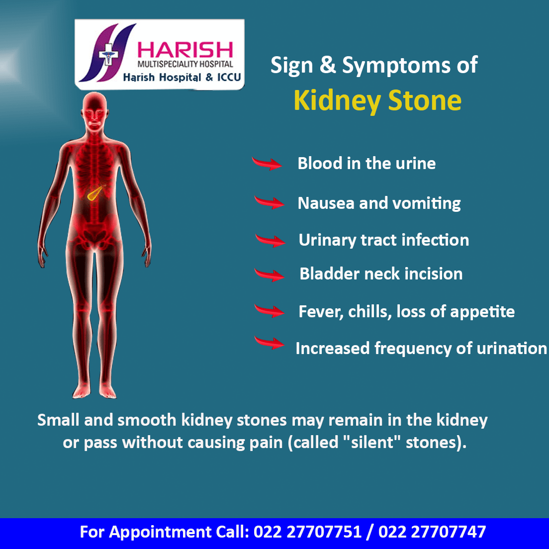 Kidney Stone Removal Laser Treatment