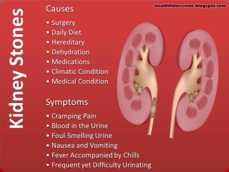 Kidney Stone Symptoms Cramping