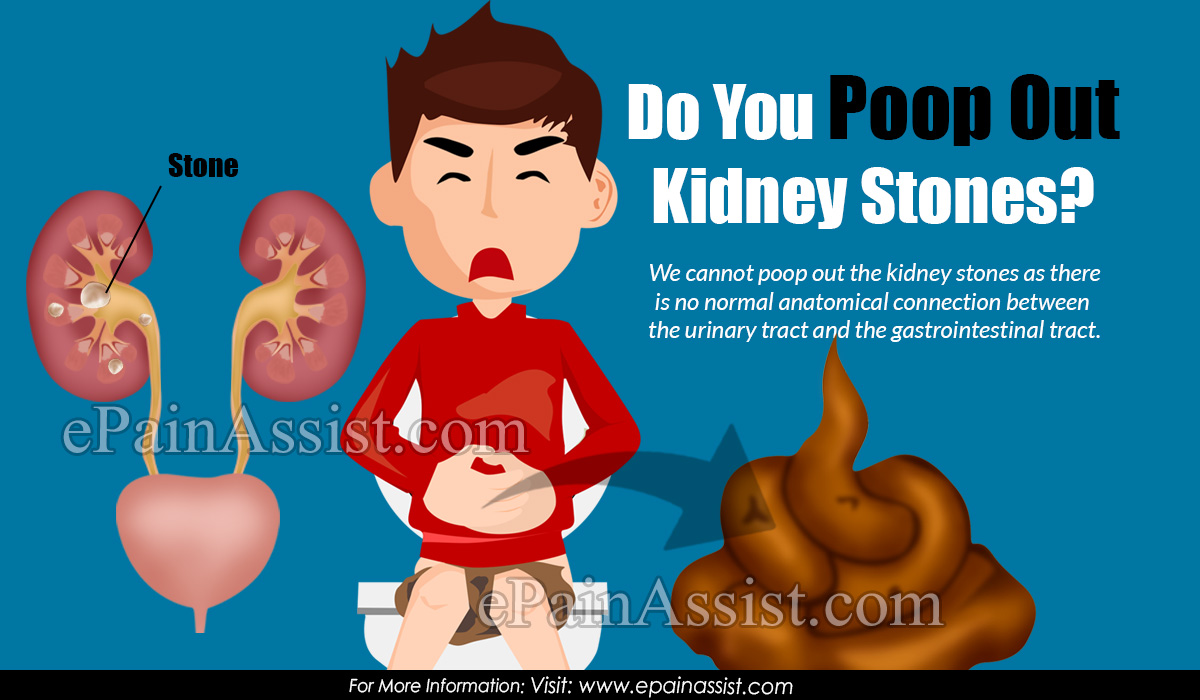 Kidney stones and poop feeling ONETTECHNOLOGIESINDIA.COM