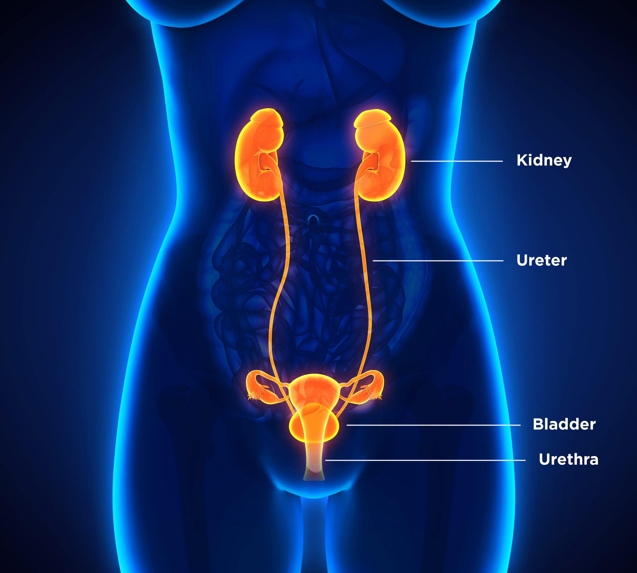 Kidney stones and treatment methods  Dornier MedTech Europe