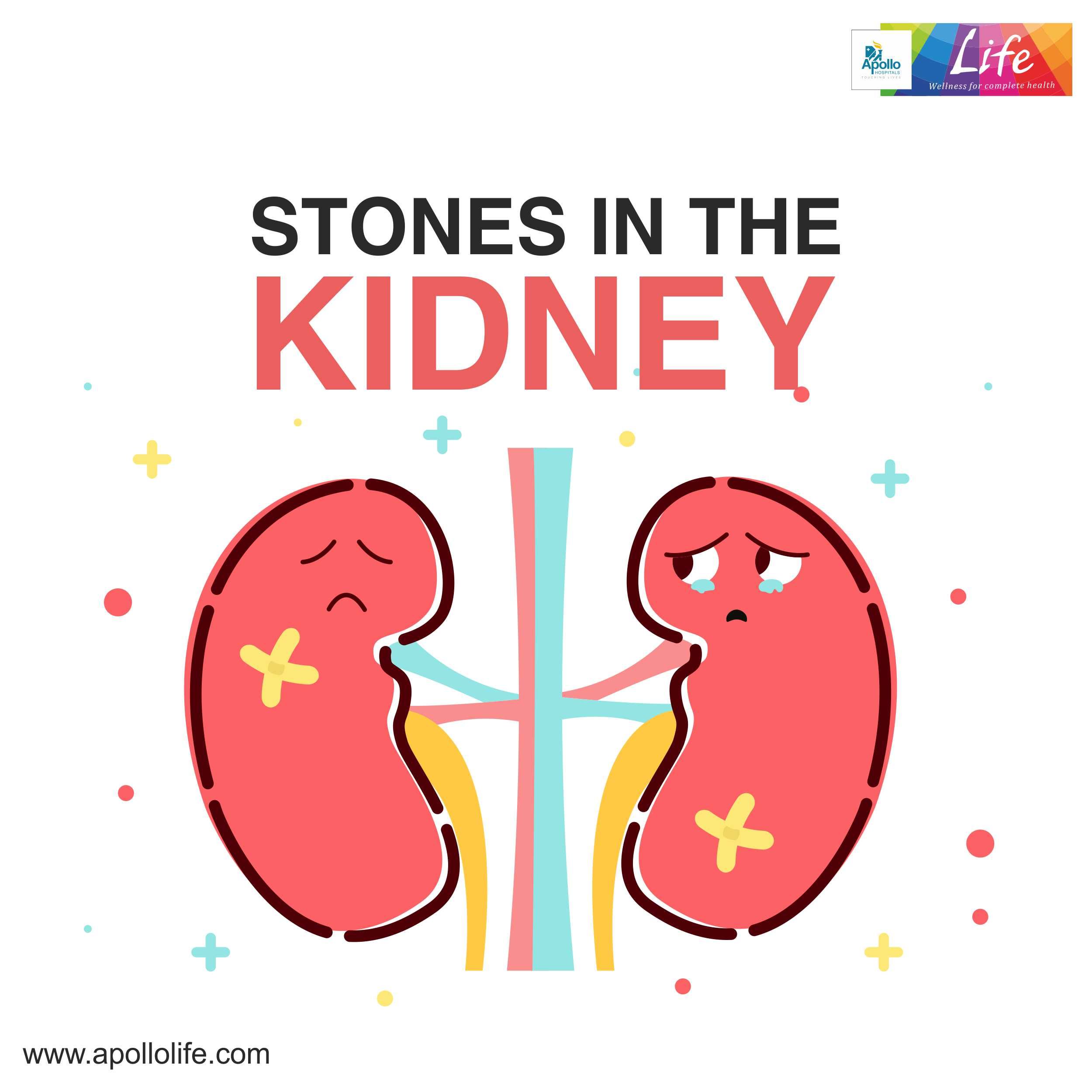 Kidney stones are formed when an imbalance occurs in various chemicals ...