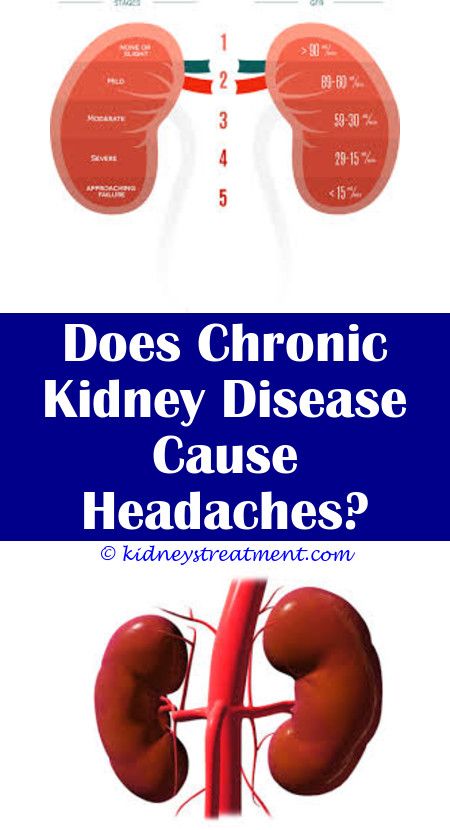 Kidney Stones Cause Headaches