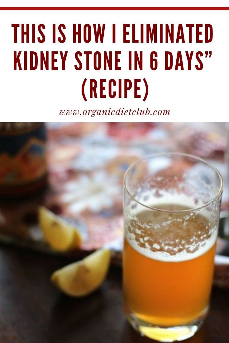 Kidney Stones Causes Alcohol