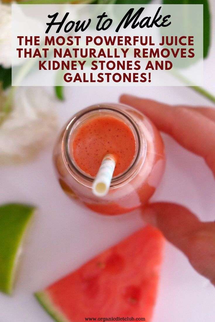 Kidney Stones Or Gallstones