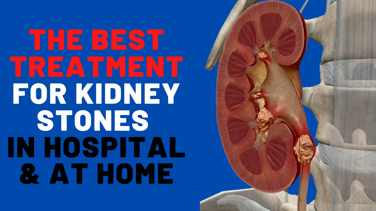 Kidney Stones &  Related Issues