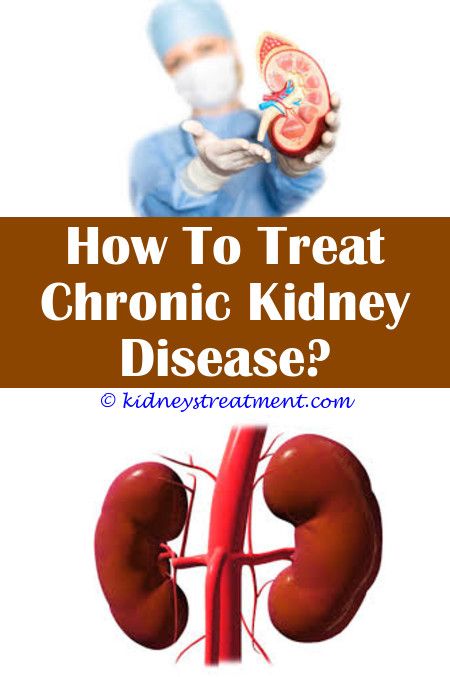 How Do Doctors Test For Kidney Stones - HealthyKidneyClub.com