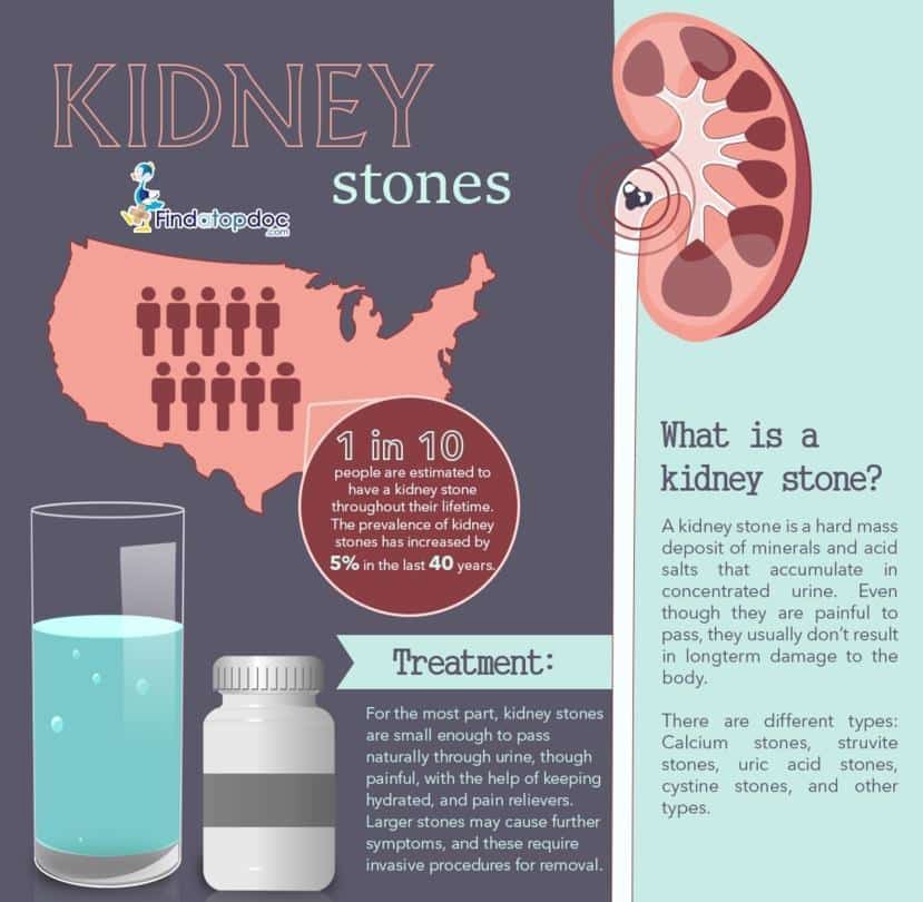 Kidney Stones: Symptoms, Causes, Treatment, and Diagnosis