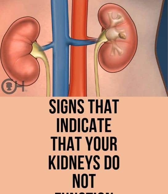 Kidney Stones Symptoms In Elderly