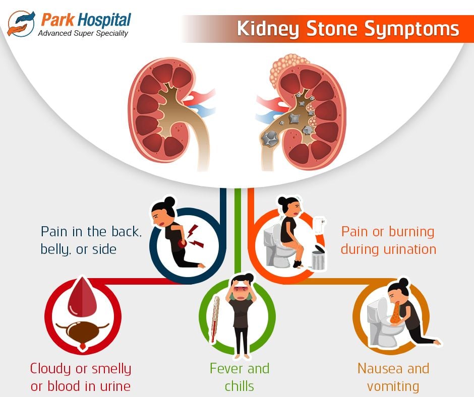 Kidney Stones Symptoms Nausea