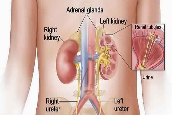 Kidney Stones Treatment in Delhi
