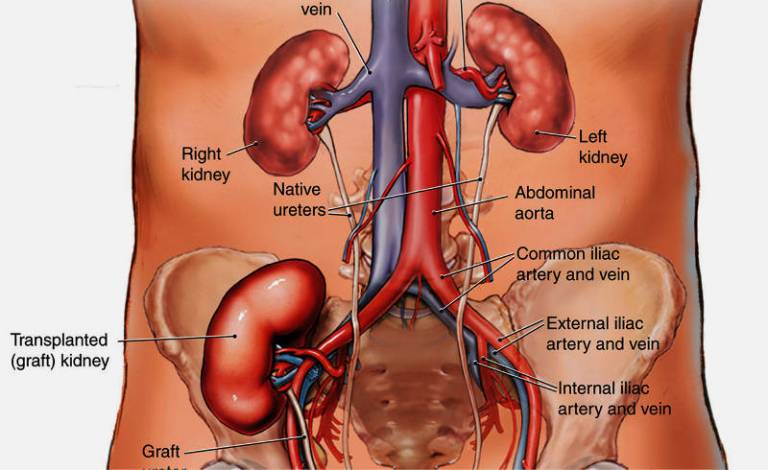 Kidney transplantation