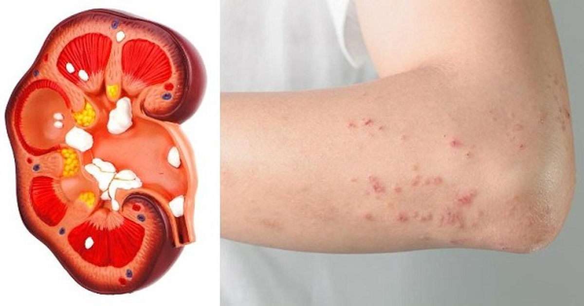 Listen To Your Body For These 10 Symptoms Of Kidney Problems