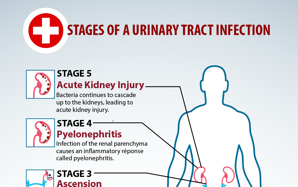 Can Water Infection Cause Back Ache