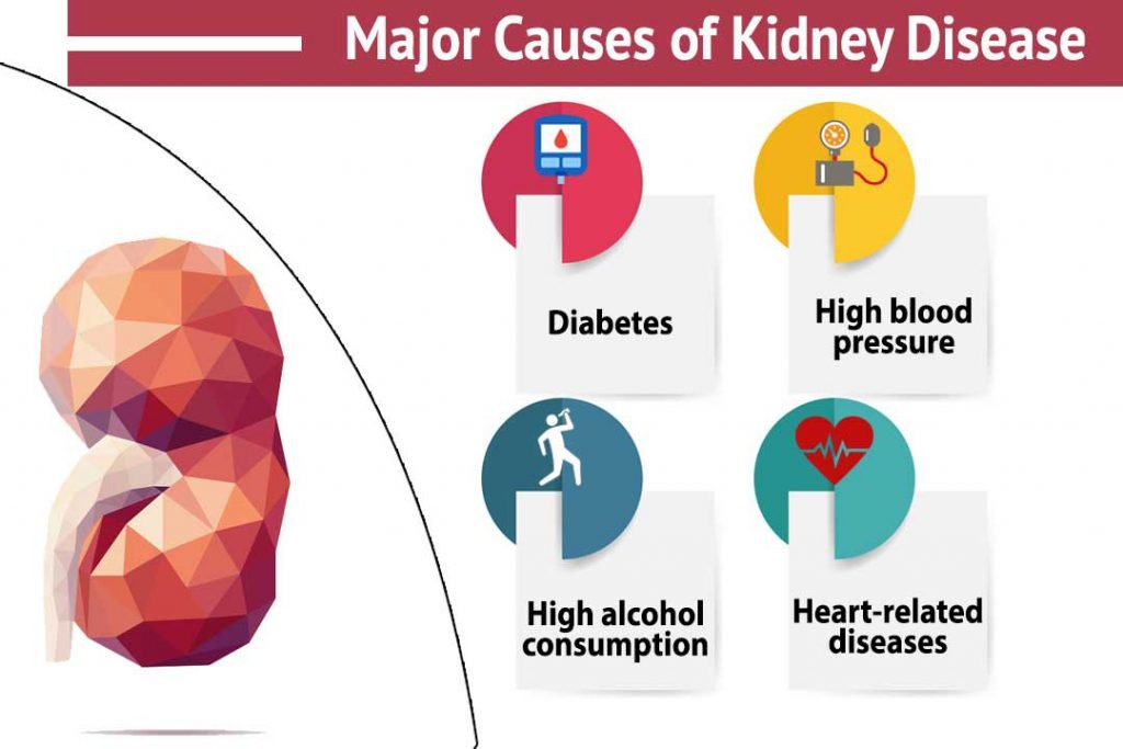 Major Causes of kidney disease!