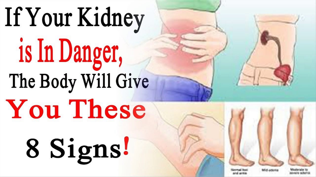 Mix · What is Kidney Failure Symptoms...?