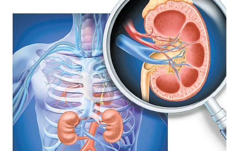 Nine reasons that can lead to kidney transplant failure ...