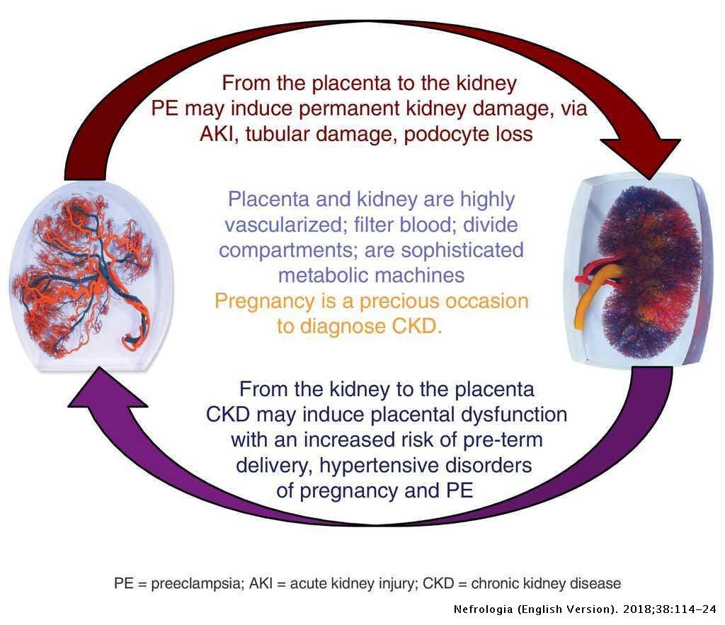 Obtain Is Kidney Failure A Disability For You ...
