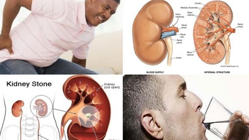Pain while passing urine could be a sign of kidney stones ...