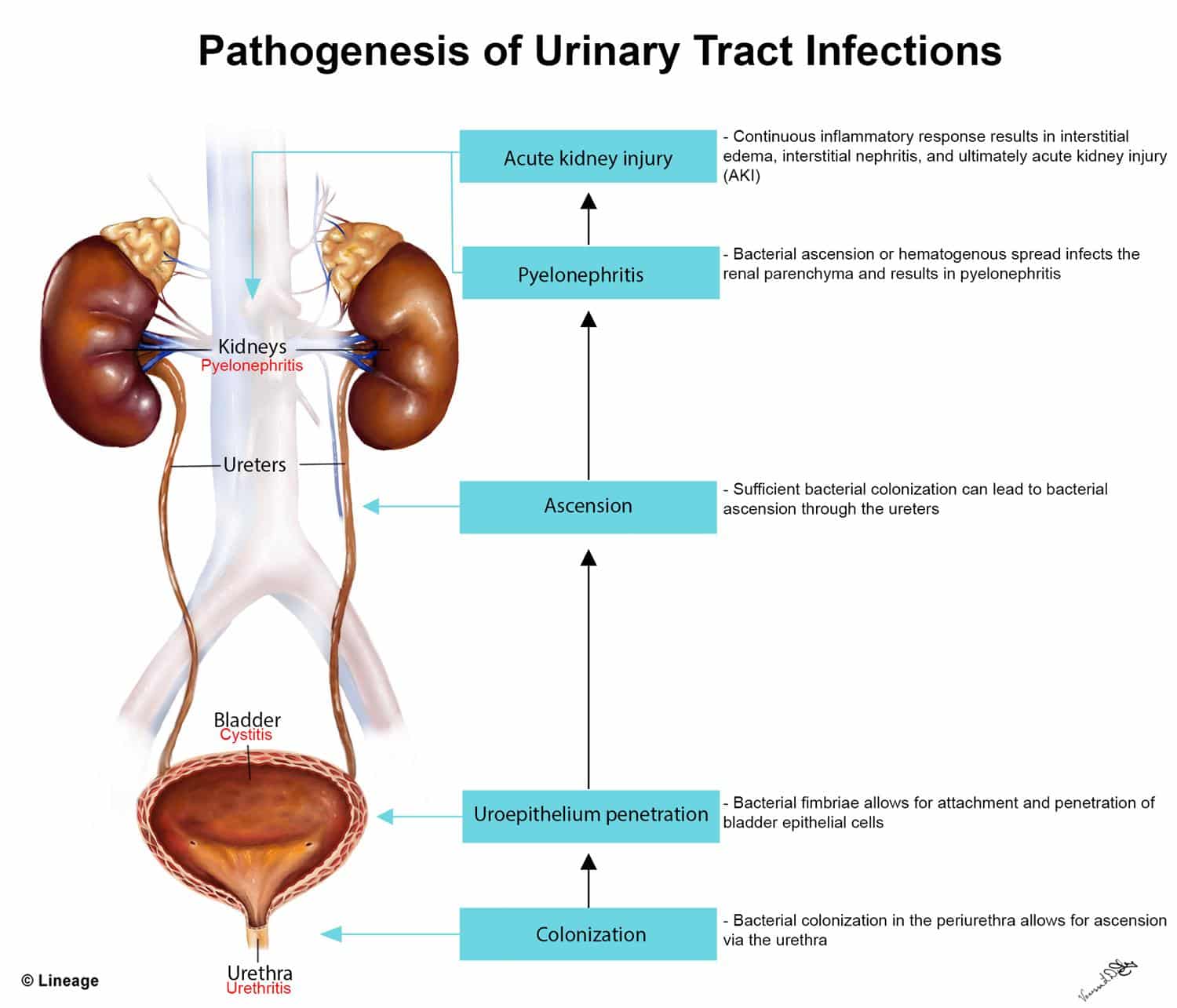 How Does A Doctor Diagnose Kidney Failure