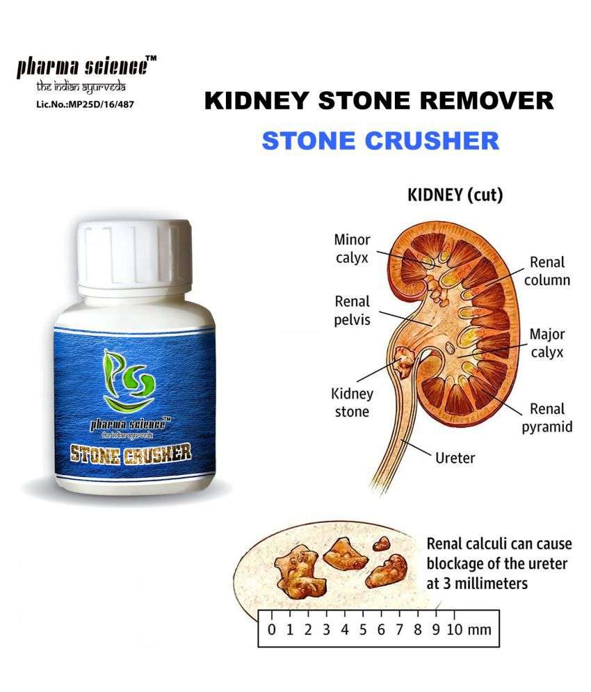 Pharma Science Ayurveda Treatment Kidney Stone Powder 20 ...