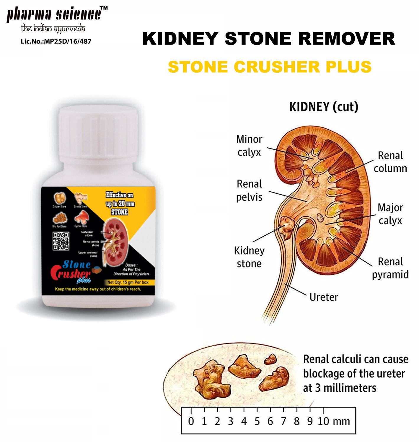 pharmascience powder Kidney Stone Pain Relief, Packaging Size: 15 Gm ...