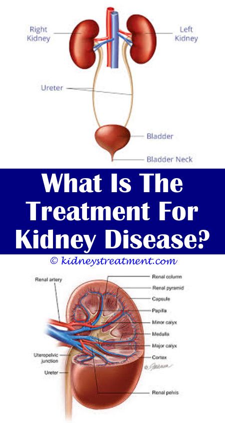 Pin on Kidney Disease Truths