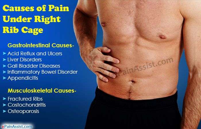 9-possible-causes-of-rib-pain