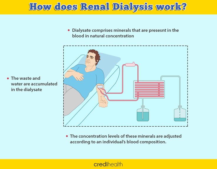 Pin on Renal Dialysis