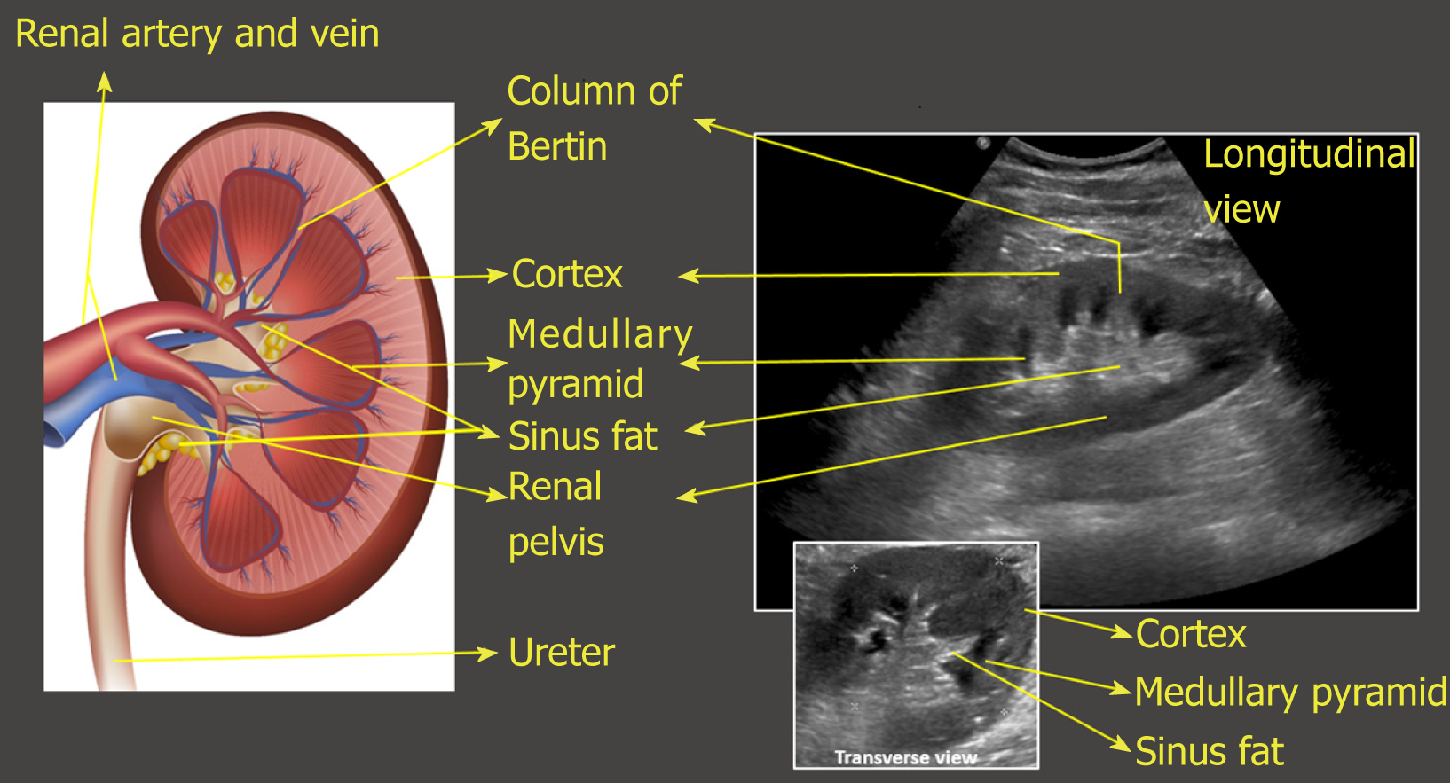 Point of care renal ultrasonography for the busy ...