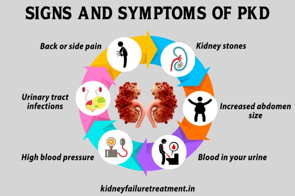 Polycystic Kidney Disease Sign, Causes, and Symptoms