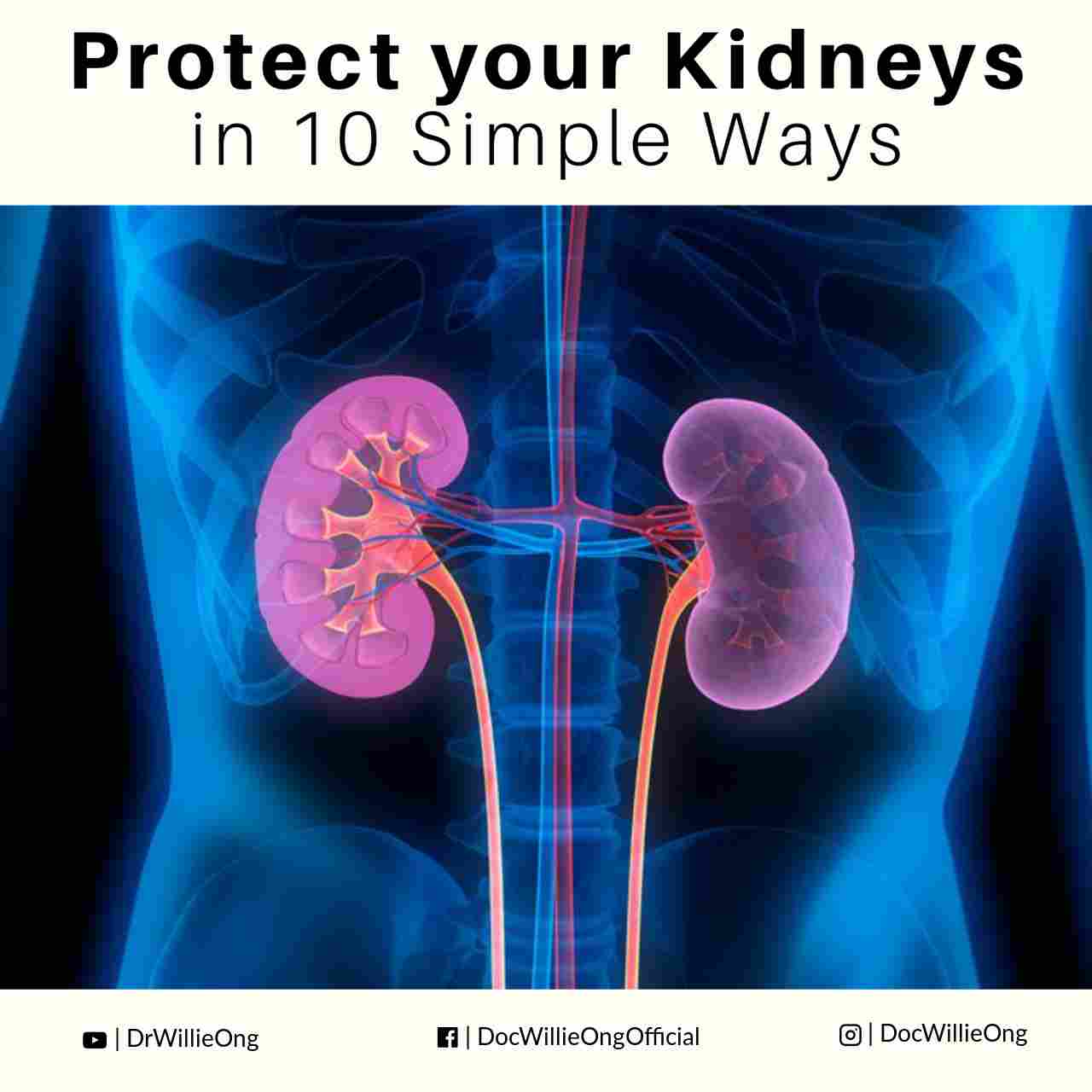 Protect Your Kidneys In Ten Simple Ways