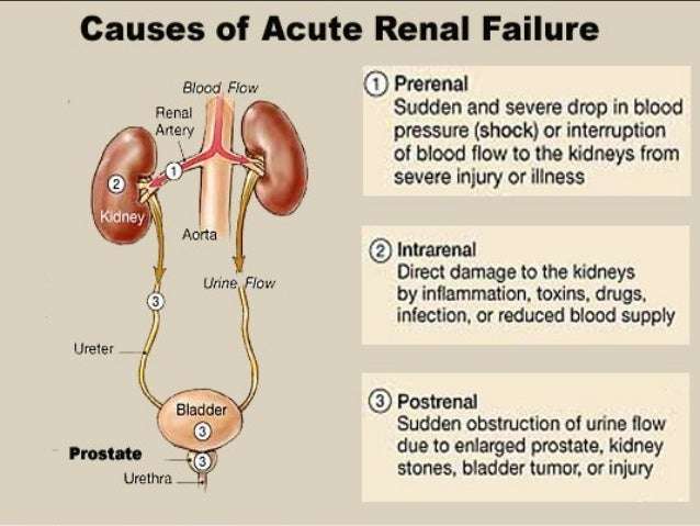 Renal failure acute and chronic