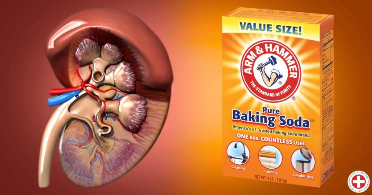 Repair Your Kidneys with Only 1 Teaspoon of Baking Soda