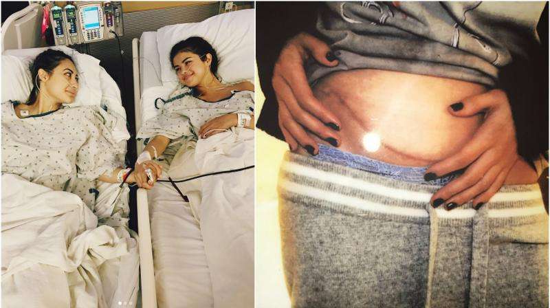 Selena Gomez undergoes kidney transplant, best friend was ...