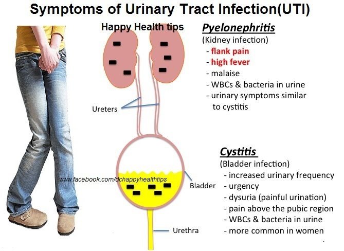 Signs &  Symptoms of a UTI. Pyelonephritis vs. Cystitis ...