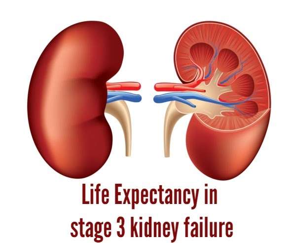 Stage 3a Kidney Disease Life Expectancy