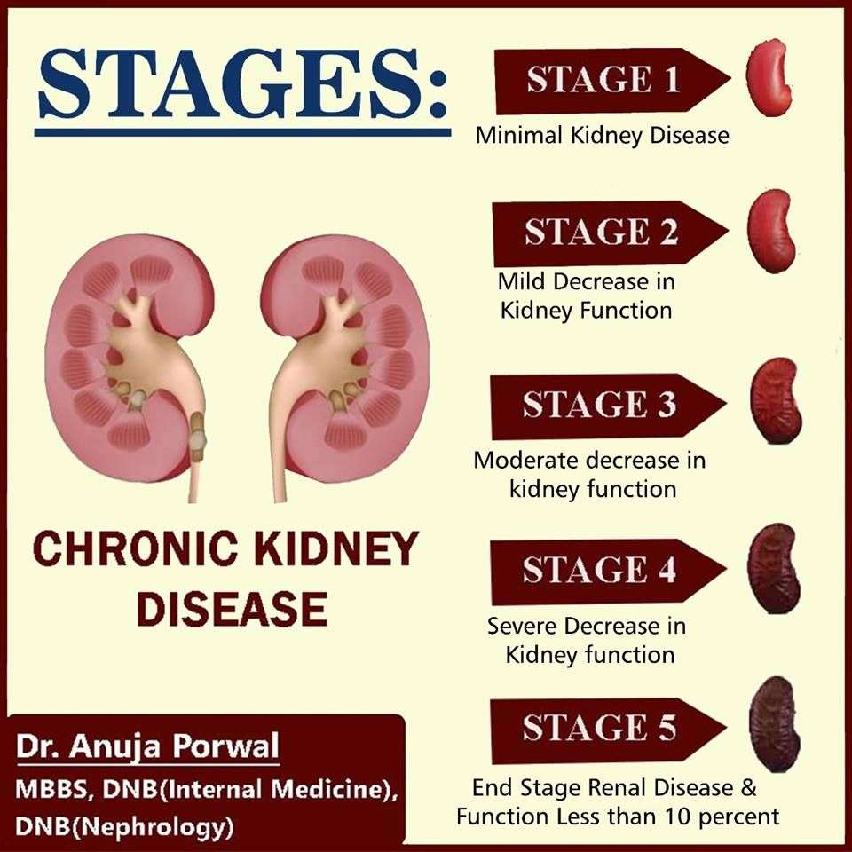 Stages of Chronic Kidney Disease!