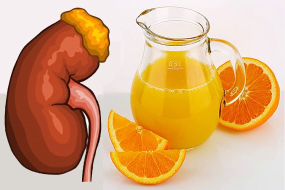 Sunburst Oranges: Eating Oranges and Drinking Orange Juice ...