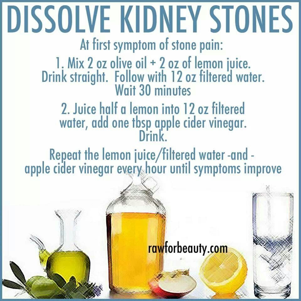 The 25+ best Passing kidney stones ideas on Pinterest ...