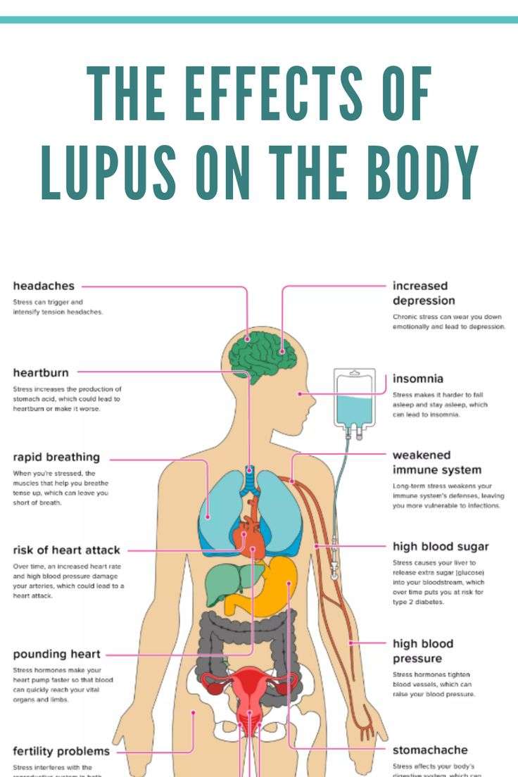 The Effects of Lupus on the Body  Schoen Med