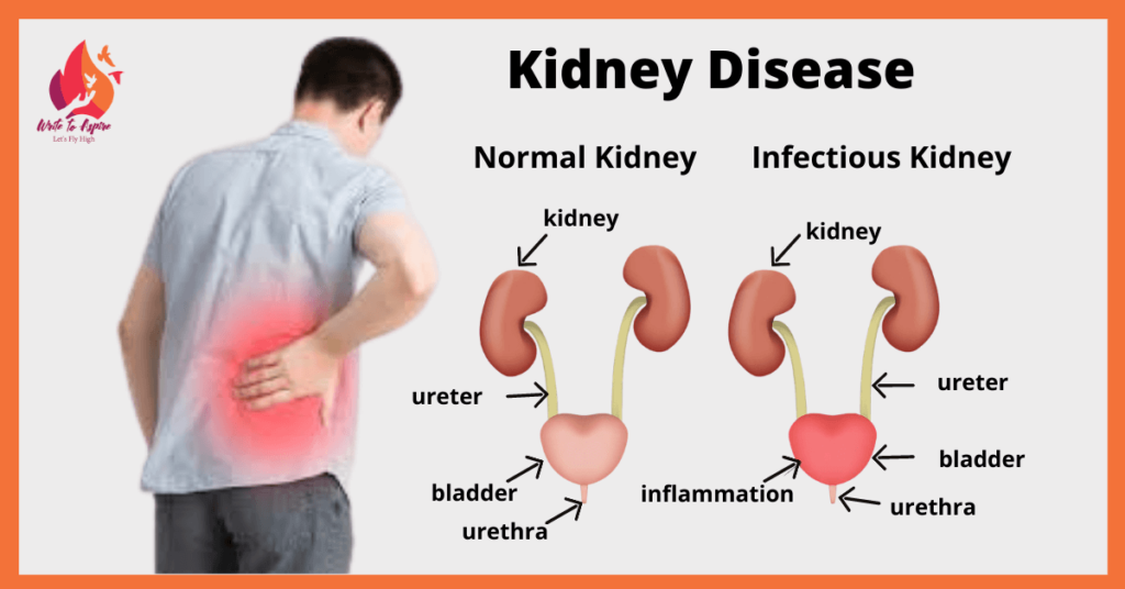 What Is Good For Kidney Infection - HealthyKidneyClub.com
