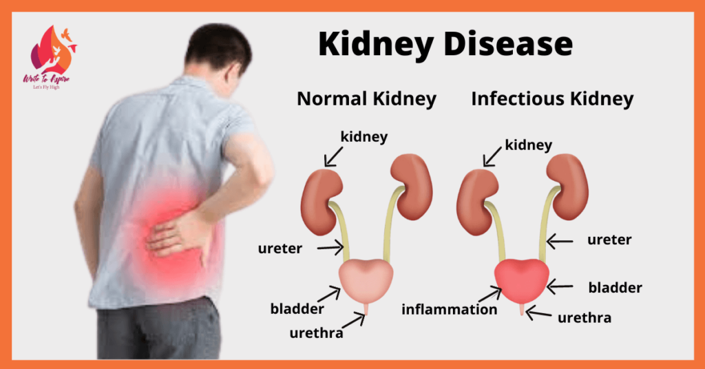 What Does A Kidney Infection Turn Into