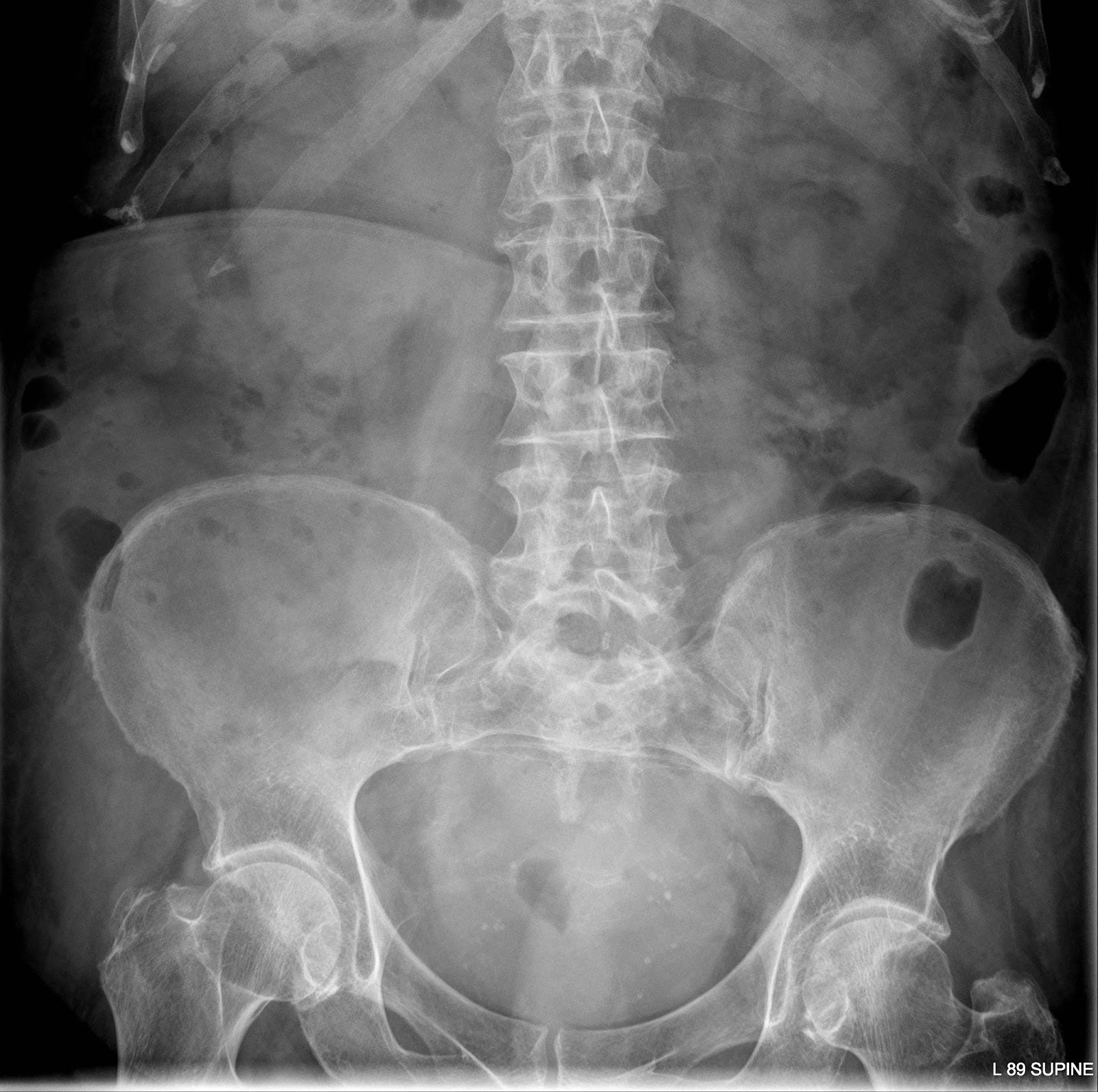 the xray doctor: xrayoftheweek 7: why is this person unwell?
