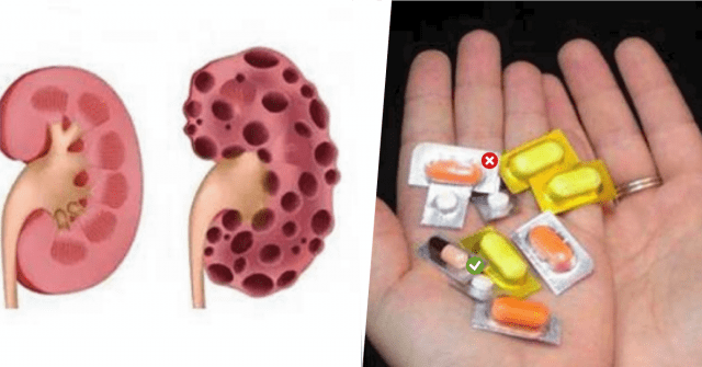 These Medications Can Destroy Your Kidney Health, But ...